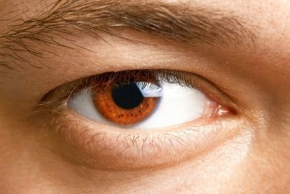 Nahaufnahme des Auges eines Mannes, dessen Oberlidhaut bis an den Wimpernrand reicht.